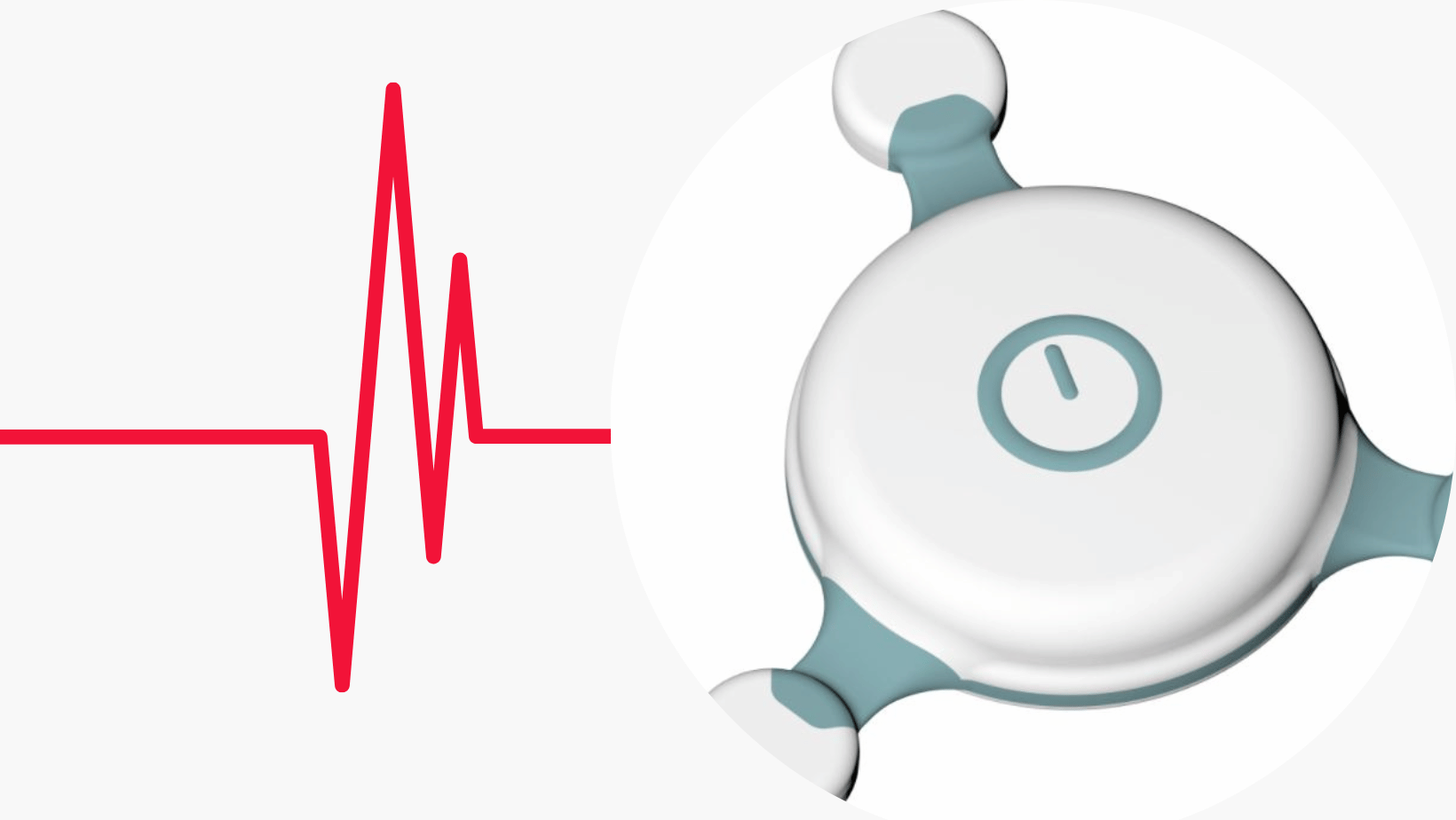 Holter EKG előnyei