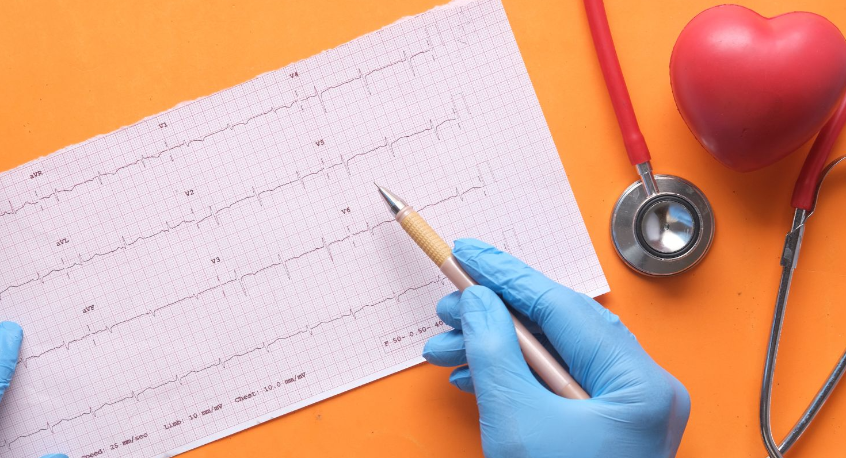 7 napos Holter EKG – amikor nem elég a 24 órás EKG