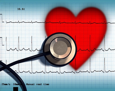 Mikor szükséges a 24 órás Holter EKG?