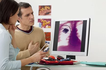 Pacemaker vagy defibrillátor beültetés után így lehet biztonságban