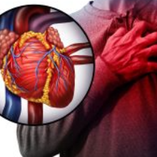 Koszorúér-betegség: mi a szerepe a sztentnek, a gyógyszereknek és az életmódnak?