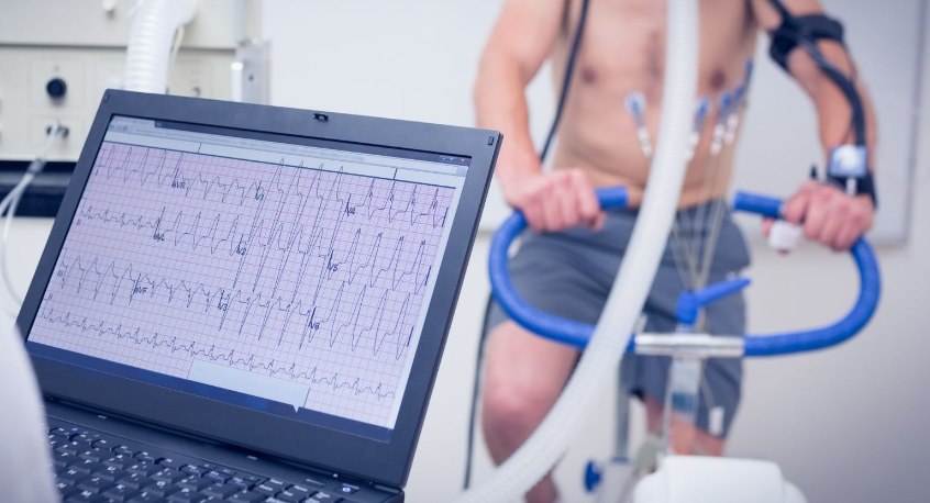 Mikor szükséges nyugalmi és mikor terheléses EKG?