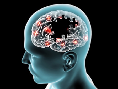 Deemencia, Alzheimer-kór esetén fontos a vérnyomás rendezése.