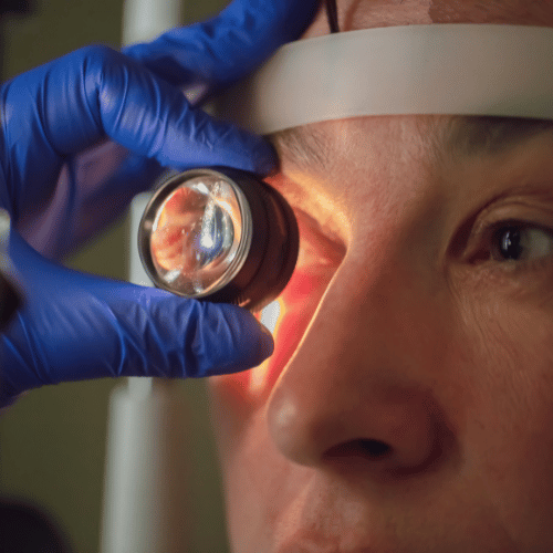 Magas vérnyomás okozta szemproblémák - Kardioközpont Magas vérnyomás okozta szemproblémák - Kardioközpont