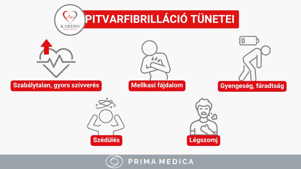 Pitvarfibrilláció tünetei - Kardioközpont